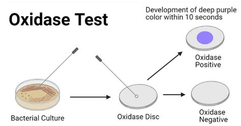Oxidase test : Principle, Protocol, Uses and Results.